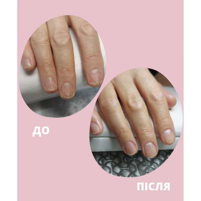 Oil for damage to the nail plate Stop Onycholysis Shelly 30 ML