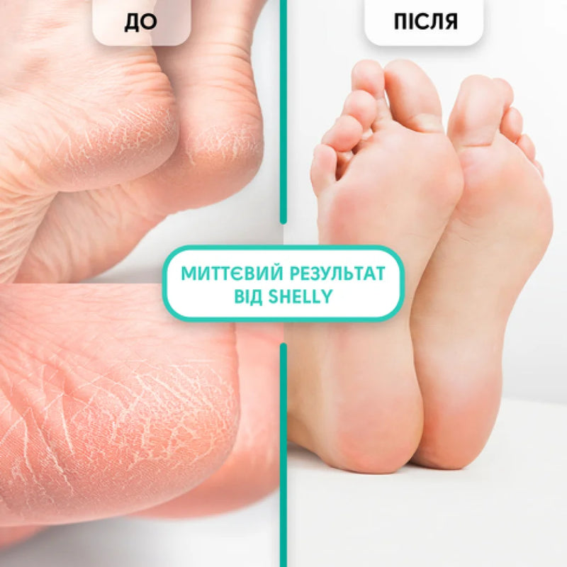 Gel-keratolytic for local use Shelly soft blade 100 ml